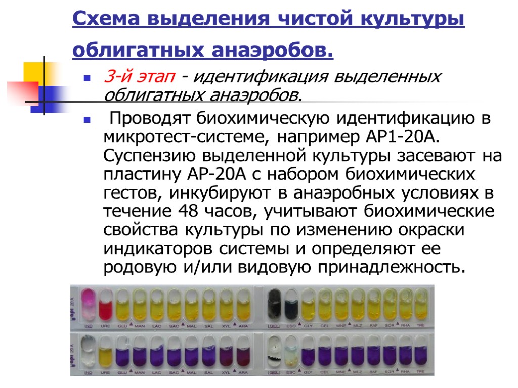 3-й этап - идентификация выделенных облигатных анаэробов. Проводят биохимическую идентификацию в микротест-системе, например АР1-20А.